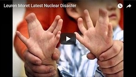 Mutated nuclear industry kids in Japan from Fukushima meltdowns suffer extra fingers, toes, arms & legs