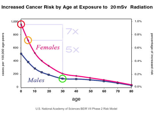 Increased cancer risk by age ...at exposure to 20 mSv nuclear radiation 