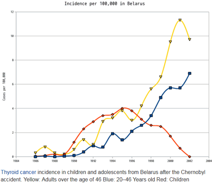 Cancer in kids in Belarus from the Chernobyl meltdown