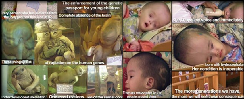Nuclear radiation hurts & mutates children Nuclear radiation hurts & mutates children