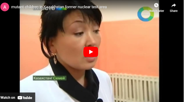 mutant children in Kazakhstan former nuclear test area