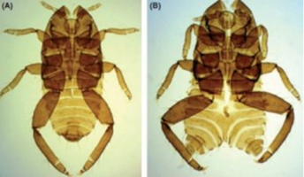 Insect abnormalities Insect abnormalities